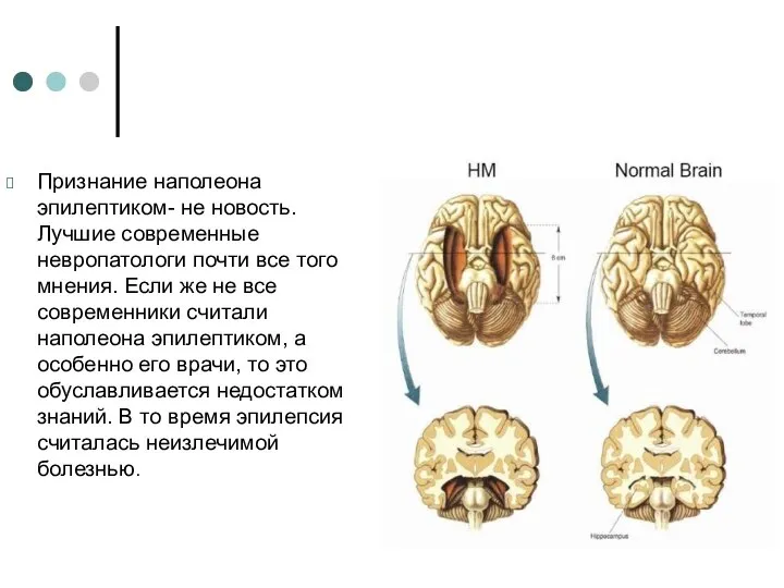 Признание наполеона эпилептиком- не новость. Лучшие современные невропатологи почти все того