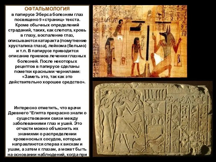 ОФТАЛЬМОЛОГИЯ в папирусе Эберса болезням глаз посвящено 9 «страниц» текста. Кроме