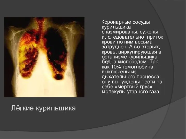 Коронарные сосуды курильщика спазмированы, сужены, и, следовательно, приток крови по ним