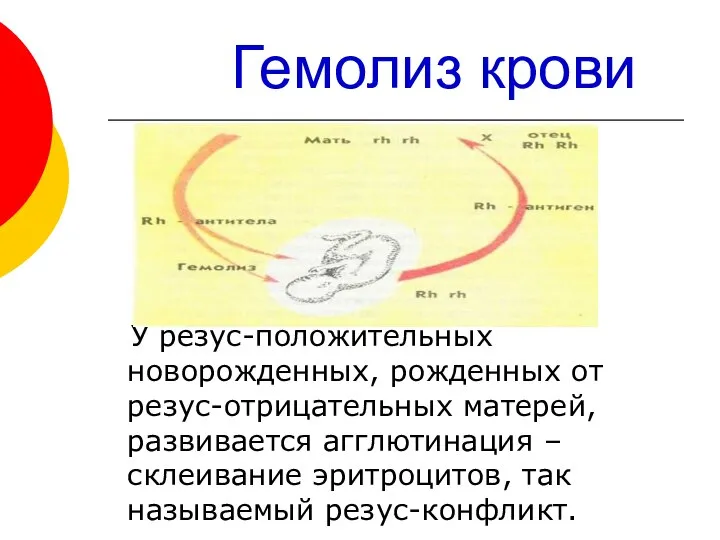 Гемолиз крови У резус-положительных новорожденных, рожденных от резус-отрицательных матерей, развивается агглютинация