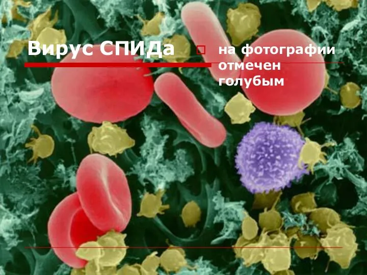 Вирус СПИДа на фотографии отмечен голубым