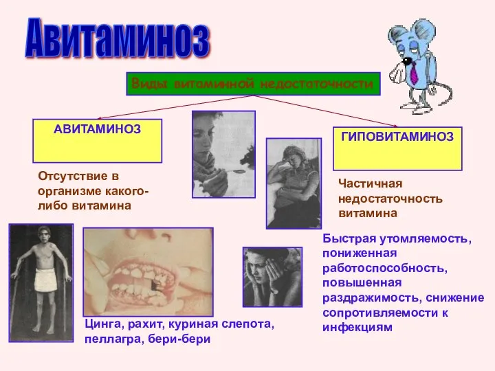 Авитаминоз Виды витаминной недостаточности АВИТАМИНОЗ ГИПОВИТАМИНОЗ Отсутствие в организме какого-либо витамина