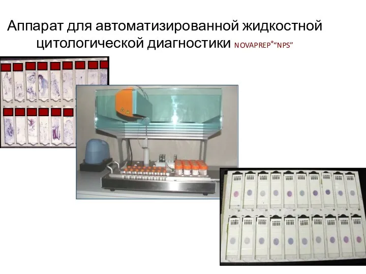 Аппарат для автоматизированной жидкостной цитологической диагностики NOVAPREP®“NPS”