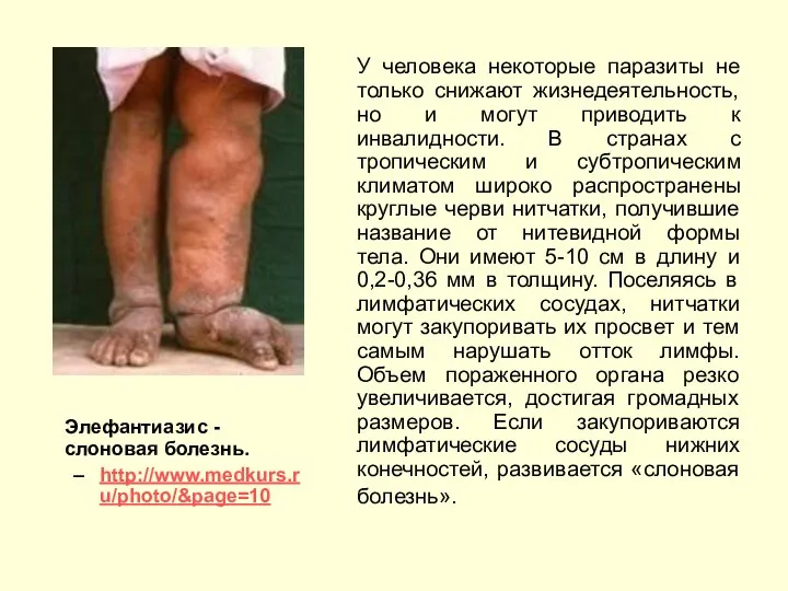 Элефантиазис - cлоновая болезнь. http://www.medkurs.ru/photo/&page=10 У человека некоторые паразиты не только