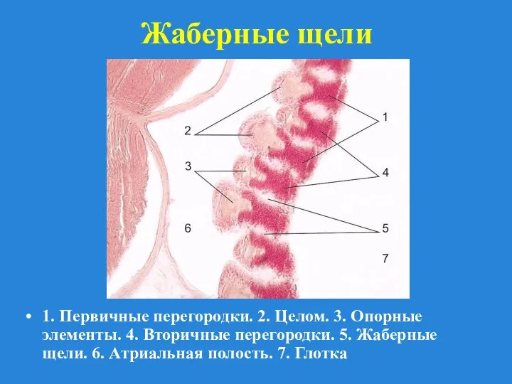 Жаберные щели 1. Первичные перегородки. 2. Целом. 3. Опорные элементы. 4.