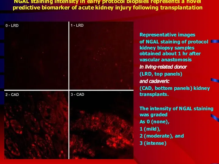 NGAL staining intensity in early protocol biopsies represents a novel predictive