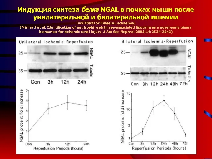 Индукция синтеза белка NGAL в почках мыши после унилатеральной и билатеральной