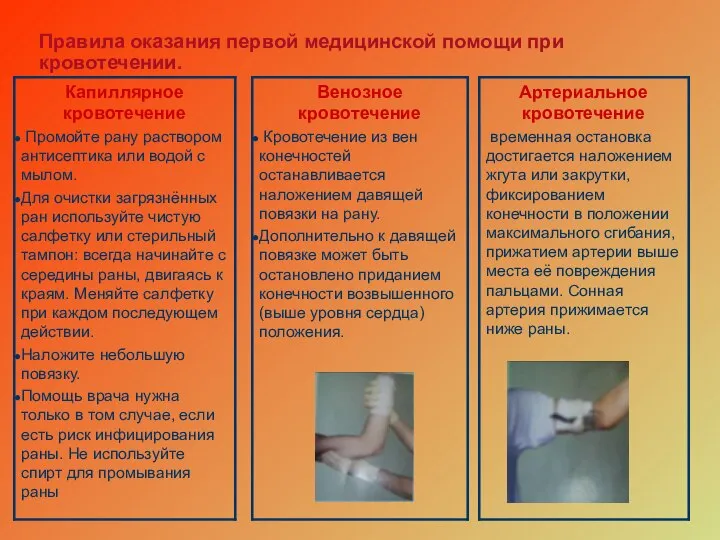 Правила оказания первой медицинской помощи при кровотечении.