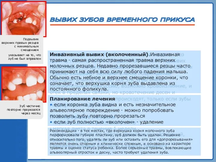 ТРАВМА ЗУБА Ушиб и подвывих. Ушиб ‑ травма зуба и связки