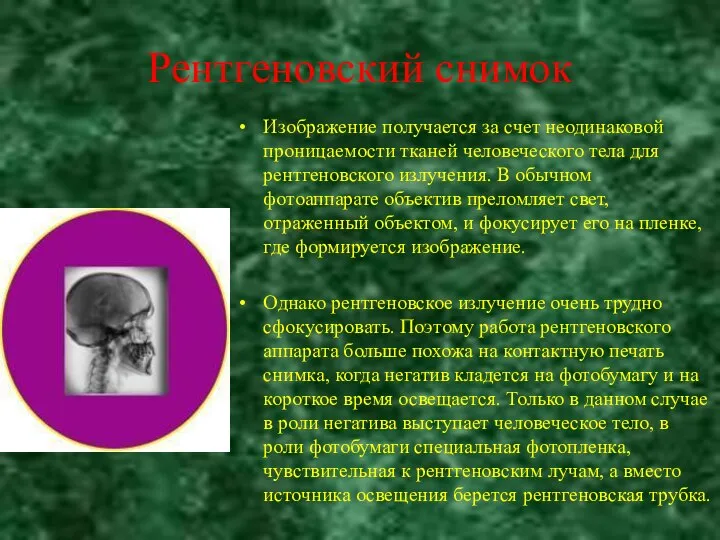 Рентгеновский снимок Изображение получается за счет неодинаковой проницаемости тканей человеческого тела