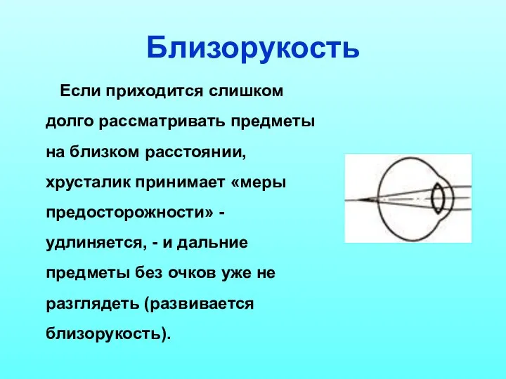 Близорукость Если приходится слишком долго рассматривать предметы на близком расстоянии, хрусталик