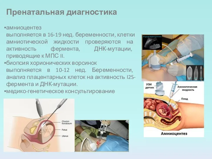 Пренатальная диагностика амниоцентез выполняется в 16-19 нед. беременности, клетки амниотической жидкости