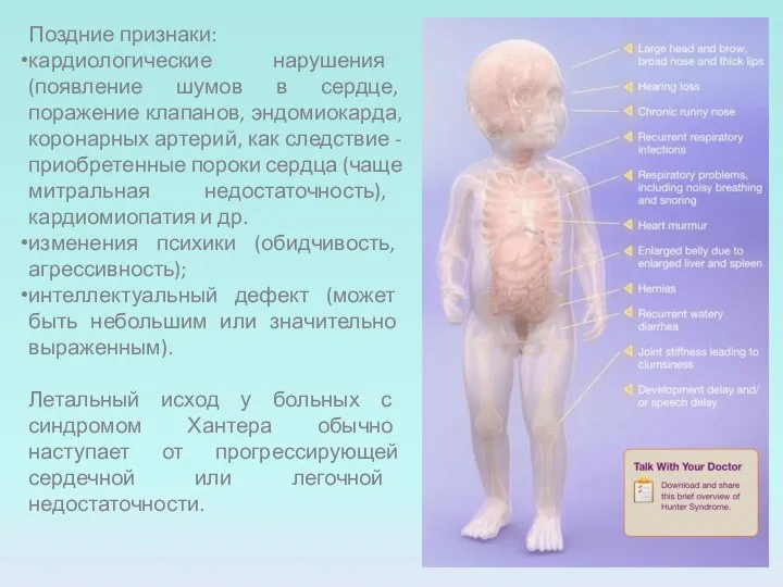 Поздние признаки: кардиологические нарушения (появление шумов в сердце, поражение клапанов, эндомиокарда,