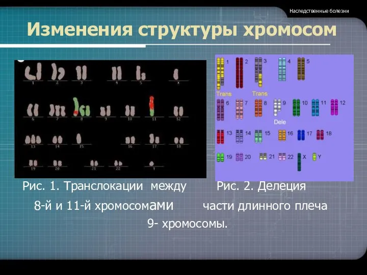 Изменения структуры хромосом Рис. 1. Транслокации между Рис. 2. Делеция 8-й