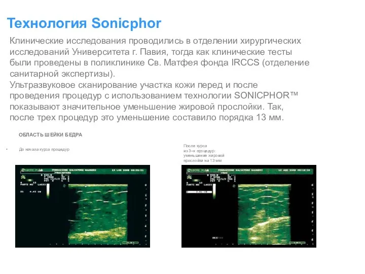 До начала курса процедур Технология Sonicphor Клинические исследования проводились в отделении