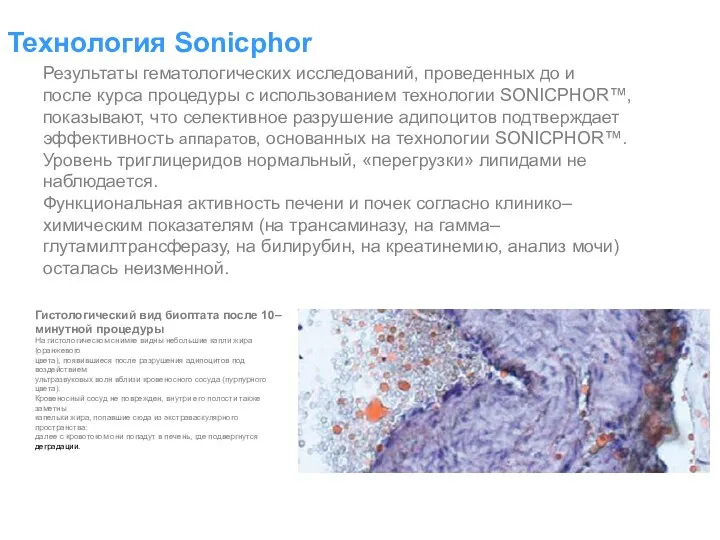 Технология Sonicphor Результаты гематологических исследований, проведенных до и после курса процедуры