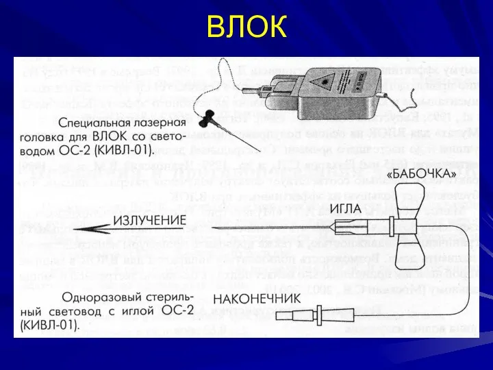 ВЛОК