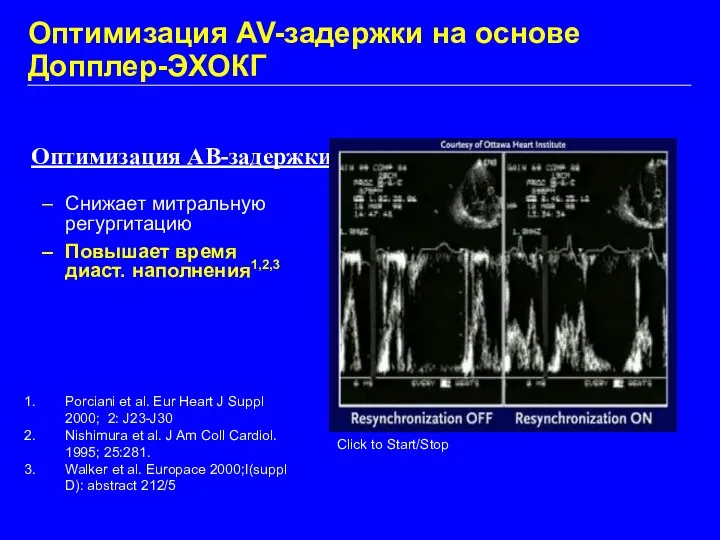 Оптимизация AV-задержки на основе Допплер-ЭХОКГ Снижает митральную регургитацию Повышает время диаст.