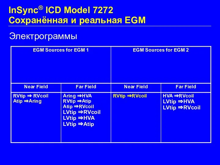 Электрограммы InSync® ICD Model 7272 Сохранённая и реальная EGM