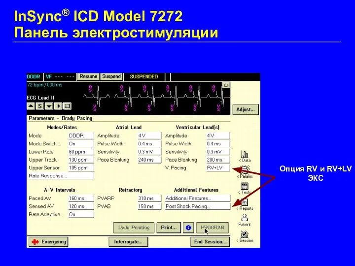 Опция RV и RV+LV ЭКС InSync® ICD Model 7272 Панель электростимуляции