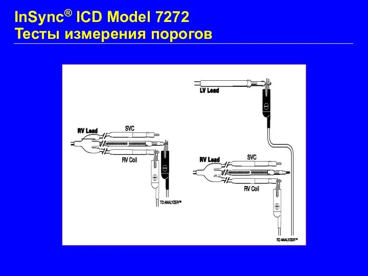 RV Testing LV Testing InSync® ICD Model 7272 Тесты измерения порогов
