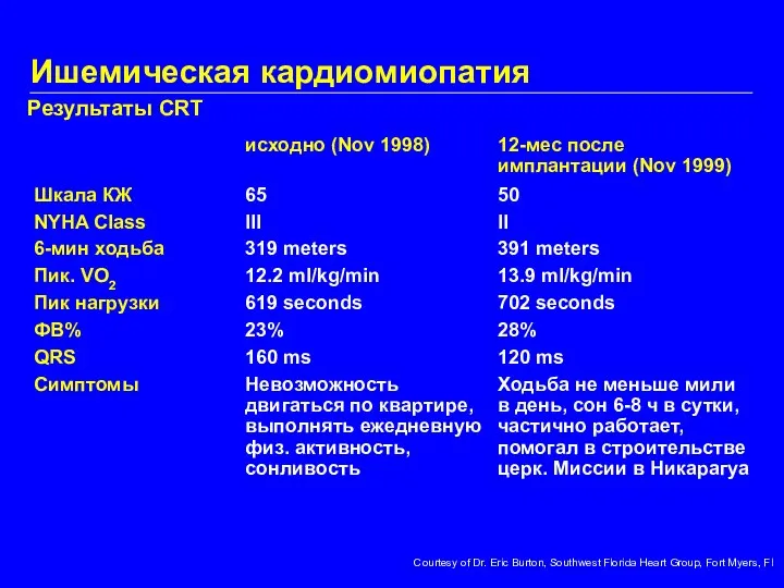 Результаты CRT Courtesy of Dr. Eric Burton, Southwest Florida Heart Group, Fort Myers, Fl Ишемическая кардиомиопатия