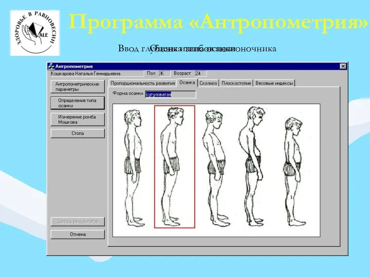 Программа «Антропометрия» Ввод глубины изгибов позвоночника Оценка типа осанки