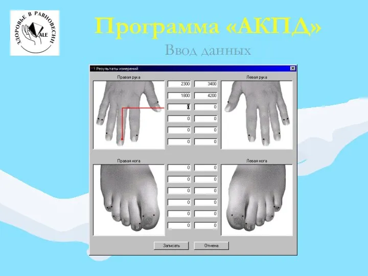 Программа «АКПД» Ввод данных