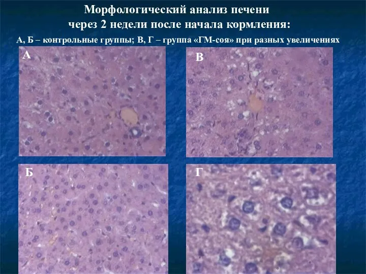 Морфологический анализ печени через 2 недели после начала кормления: А, Б