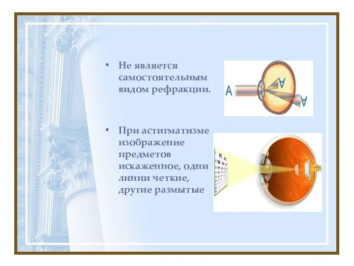 Не является самостоятельным видом рефракции. При астигматизме изображение предметов искаженное, одни линии четкие, другие размытые