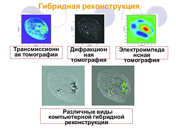 Трансмиссионная томография Дифракционная томография Электроимпедансная томография Различные виды компьютерной гибридной реконструкции Гибридная реконструкция