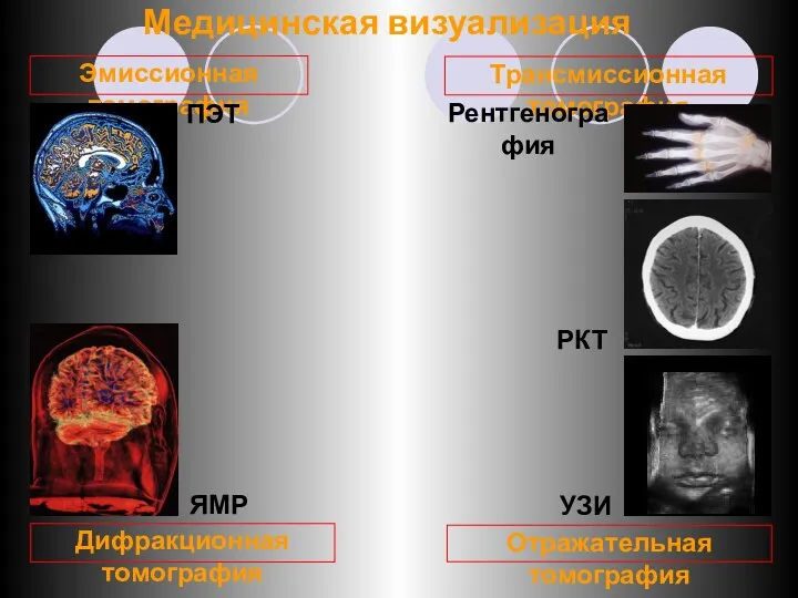 Медицинская визуализация Трансмиссионная томография Отражательная томография Эмиссионная томография Дифракционная томография