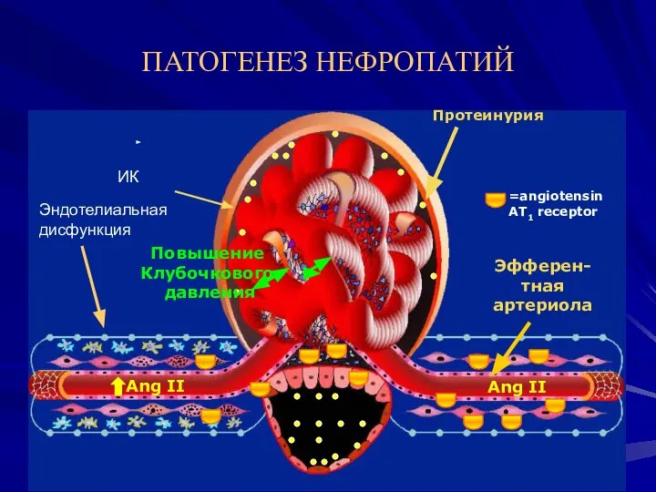 ПАТОГЕНЕЗ НЕФРОПАТИЙ Ang II Повышение Клубочкового давления Ang II Протеинурия Эфферен-тная
