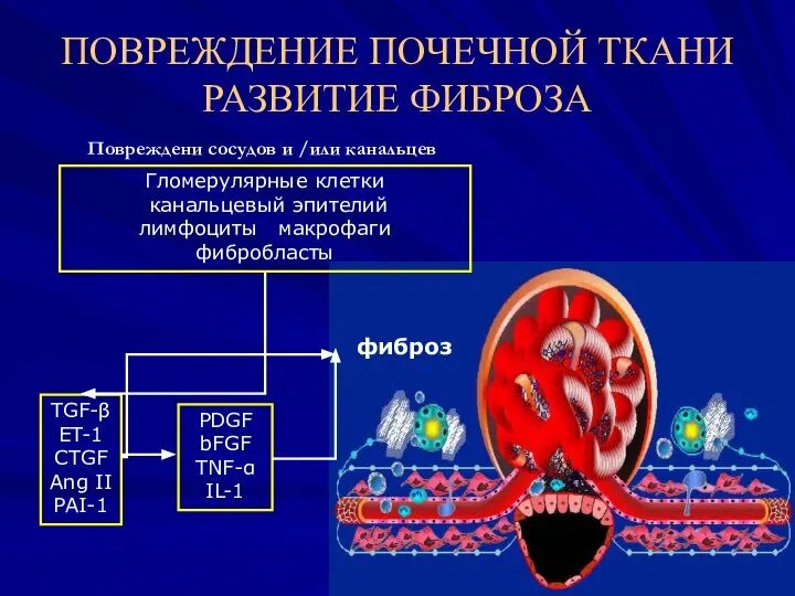 Повреждени сосудов и /или канальцев Гломерулярные клетки канальцевый эпителий лимфоциты макрофаги