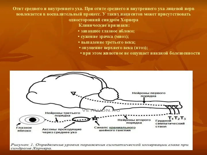 Отит среднего и внутреннего уха. При отите среднего и внутреннего уха