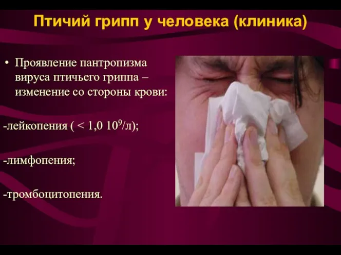 Птичий грипп у человека (клиника) Проявление пантропизма вируса птичьего гриппа –