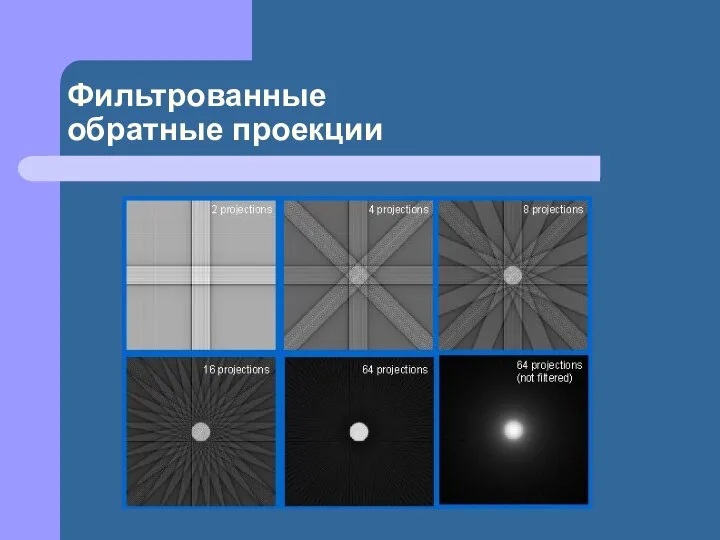 Фильтрованные обратные проекции