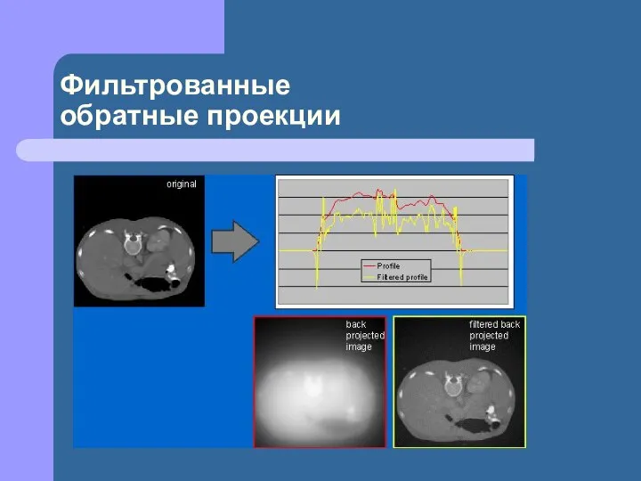 Фильтрованные обратные проекции