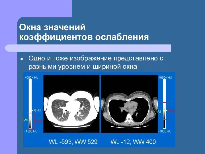 Окна значений коэффициентов ослабления Одно и тоже изображение представлено с разными уровнем и шириной окна