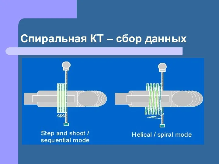 Спиральная КТ – сбор данных