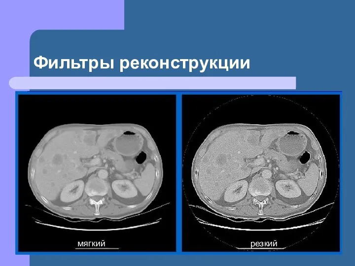 Фильтры реконструкции мягкий резкий