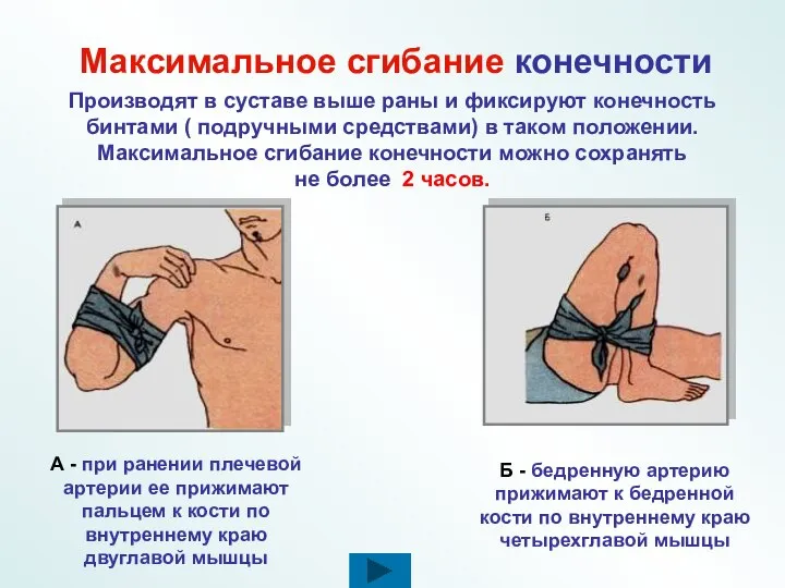 Максимальное сгибание конечности Производят в суставе выше раны и фиксируют конечность