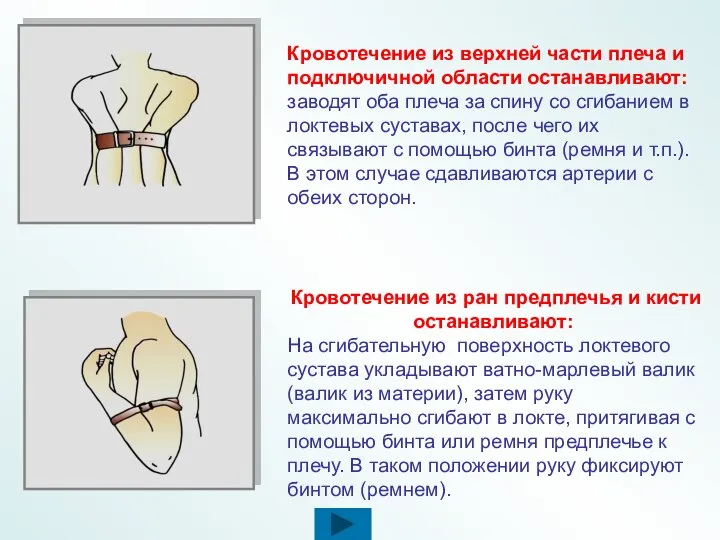 Кровотечение из верхней части плеча и подключичной области останавливают: заводят оба