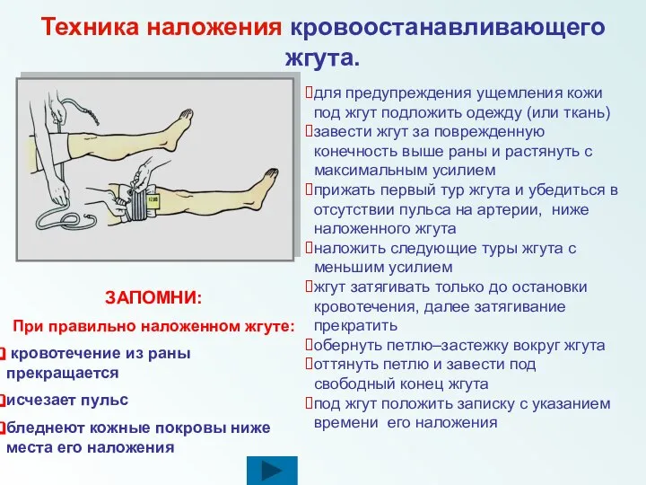 для предупреждения ущемления кожи под жгут подложить одежду (или ткань) завести