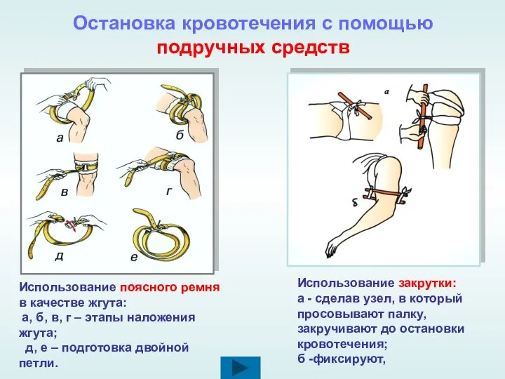 Остановка кровотечения с помощью подручных средств Использование поясного ремня в качестве