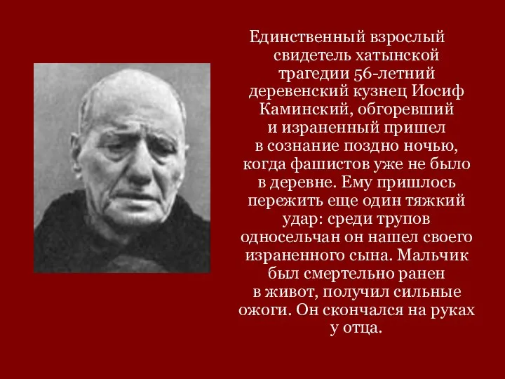 Единственный взрослый свидетель хатынской трагедии 56-летний деревенский кузнец Иосиф Каминский, обгоревший