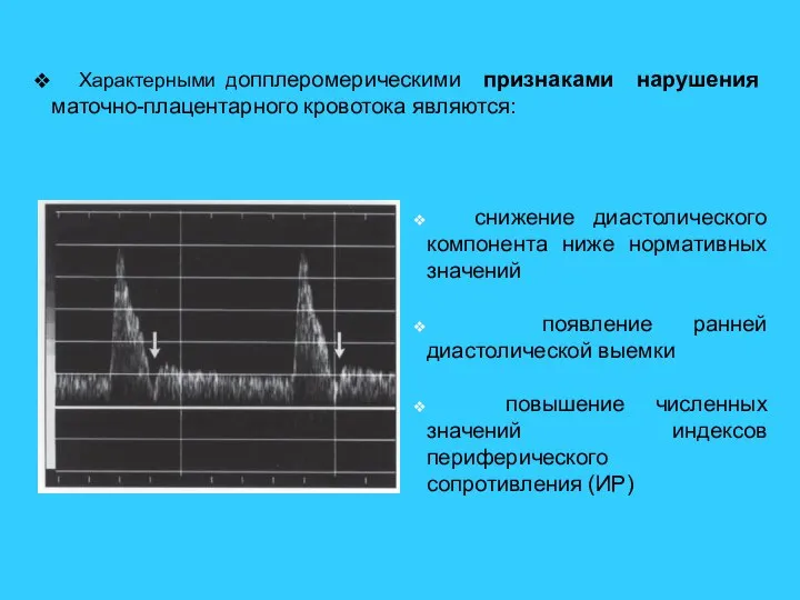 Характерными допплеромерическими признаками нарушения маточно-плацентарного кровотока являются: снижение диастолического компонента ниже