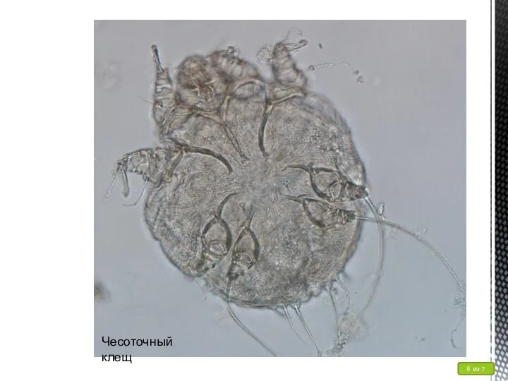 Чесоточный клещ 6 из 7