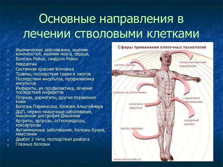 Основные направления в лечении стволовыми клетками Ишемические заболевания, ишемия конечностей, ишемия