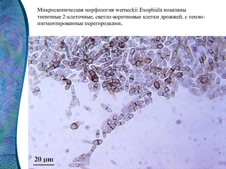 Микроскопическая морфология werneckii Exophiala показаны типичные 2-клеточные, светло-коричневые клетки дрожжей, с темно-пигментированные перегородками,